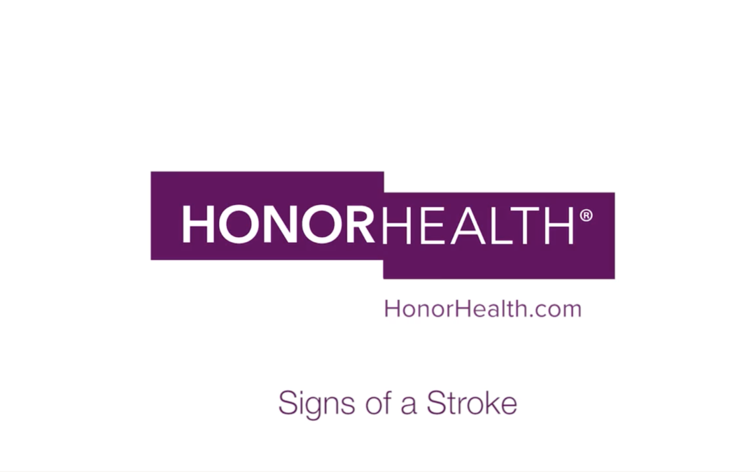 Signs of a Stroke – HonorHealth