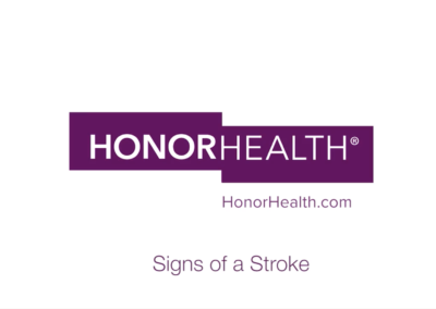 Signs of a Stroke – HonorHealth